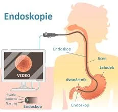 Projekt Endoskopie